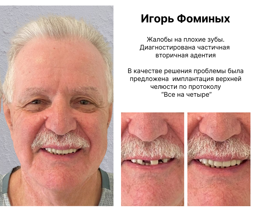 Image title