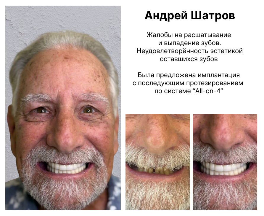 Image title