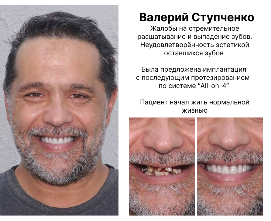 Image title