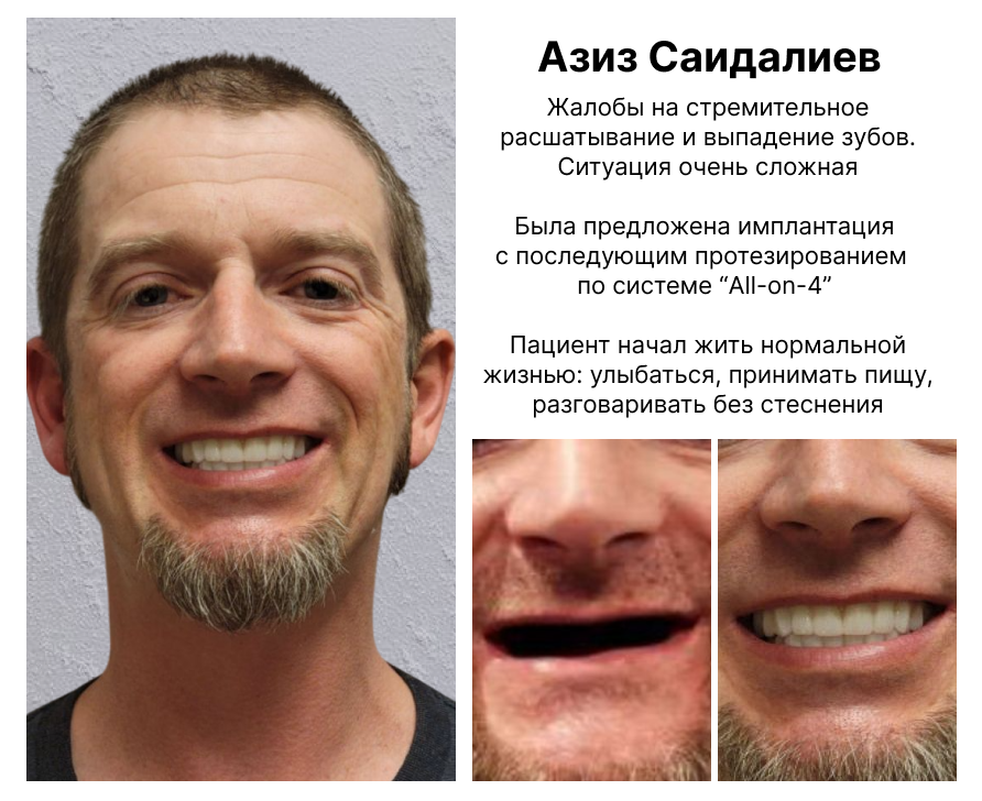 Image title