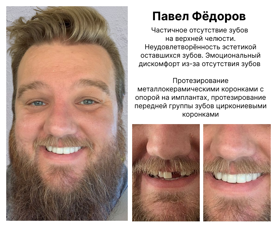 Image title